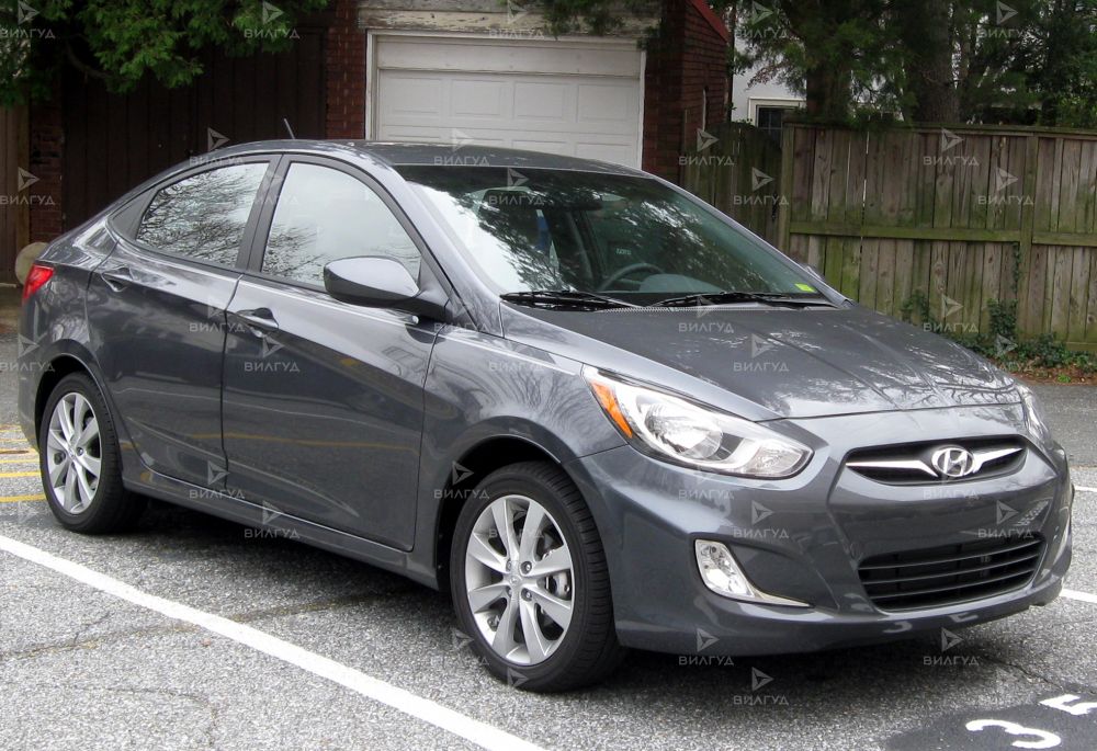 Техническое обслуживание Hyundai Accent